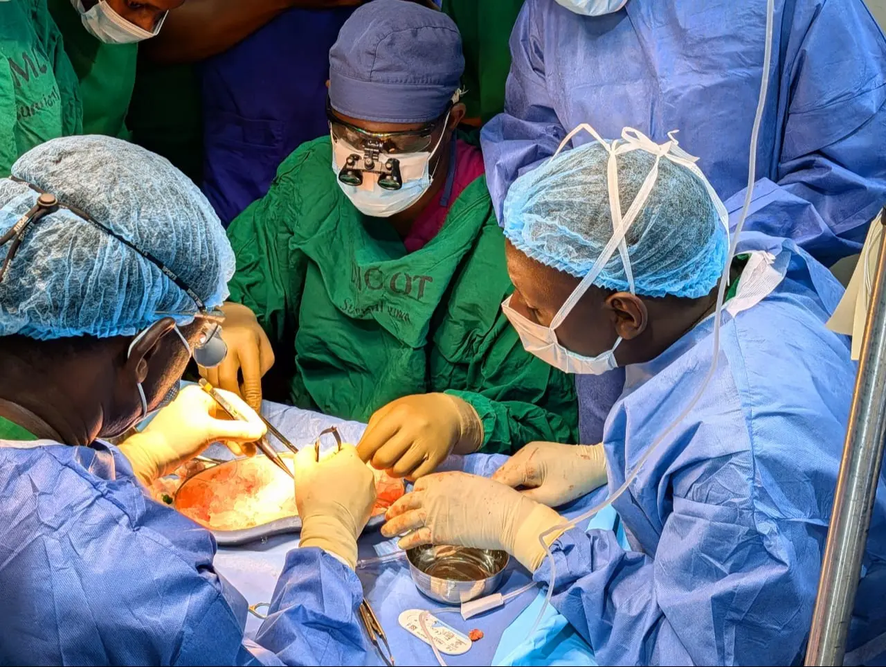 BMH NA UDOM WAIWEZESHA BUGANDO KUPANDIKIZA FIGO KWA MARA YA KWANZA